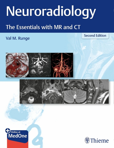 Neuroradiology - Val M. Runge