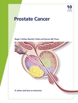 Fast Facts: Prostate Cancer - R.S. Kirby, M.I. Patel, D.M.C. Poon