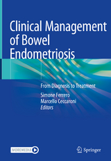 Clinical Management of Bowel Endometriosis - 