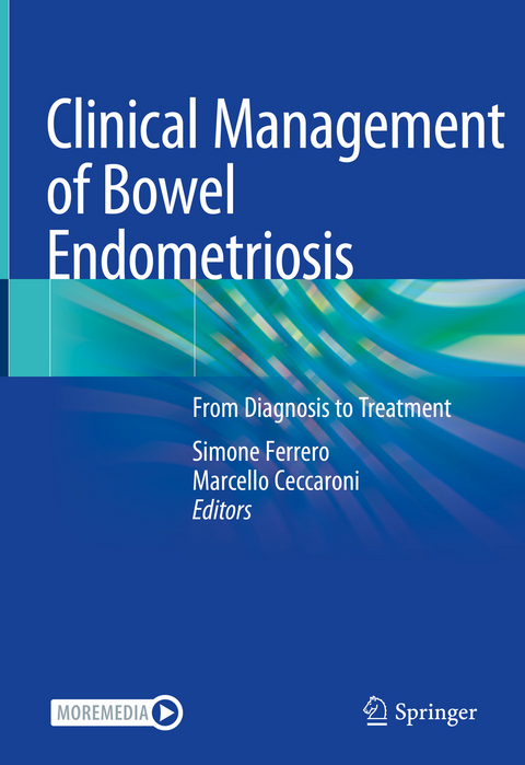 Clinical Management of Bowel Endometriosis - 