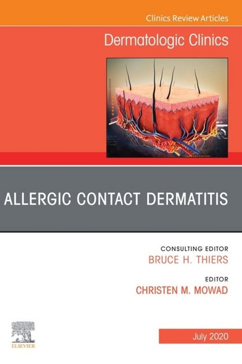 Allergic Contact Dermatitis,An Issue of Dermatologic Clinics -  E-Book -  Christen M. Mowad