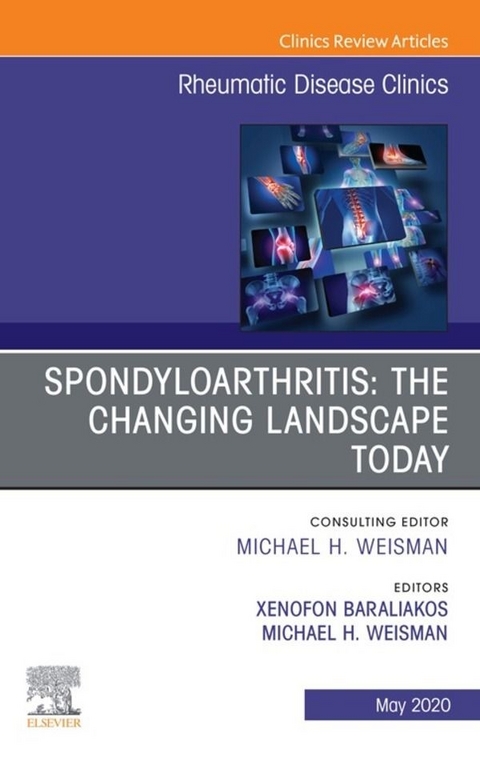 Spondyloarthritis: The Changing Landscape Today, An Issue of Rheumatic Disease Clinics of North America - 