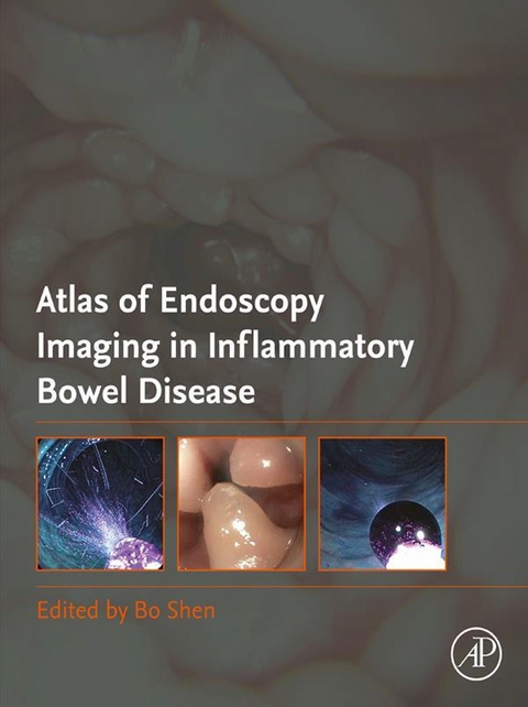 Atlas of Endoscopy Imaging in Inflammatory Bowel Disease - 