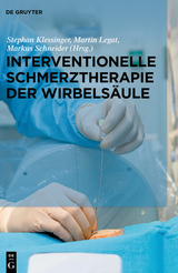 Interventionelle Schmerztherapie der Wirbelsäule - 