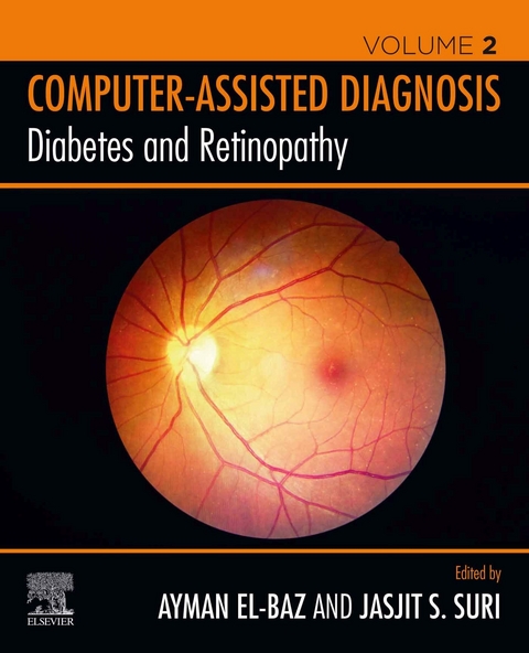 Diabetes and Retinopathy - 