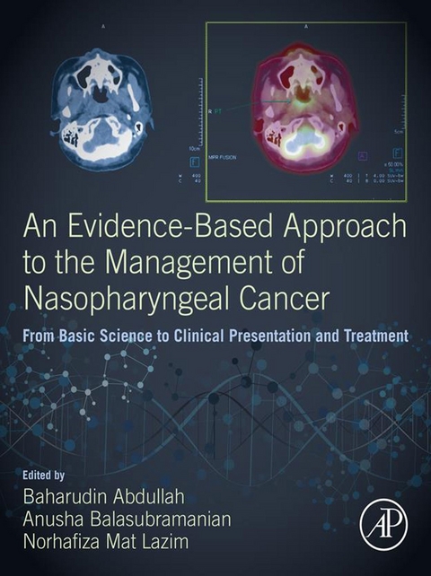 Evidence-Based Approach to the Management of Nasopharyngeal Cancer - 