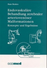 Endovaskuläre Behandlung zerebraler arterio-venöser Malformationen - Henkes, Hans