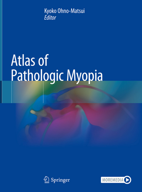 Atlas of Pathologic Myopia - 