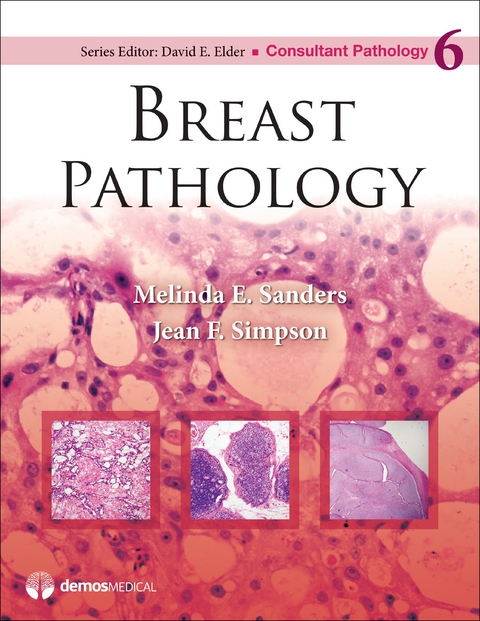 Breast Pathology -  MD Jean F. Simpson,  MD Melinda E. Sanders