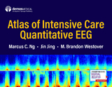 Atlas of Intensive Care Quantitative EEG - Marcus C. Ng, Jin Jing, M. Brandon Westover