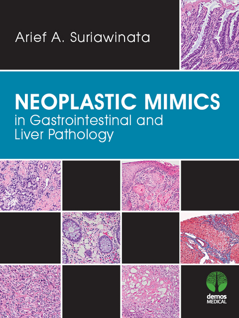 Neoplastic Mimics in Gastrointestinal and Liver Pathology - Arief Suriawinata