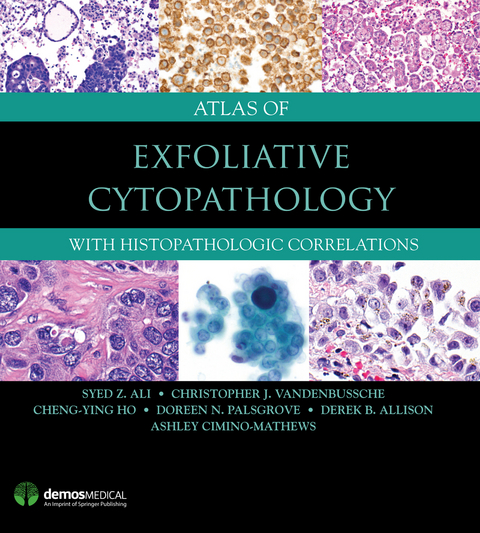 Atlas of Exfoliative Cytopathology - Syed Z. Ali, Christopher J. VandenBussche, Cheng-Ying Ho, Doreen N. Palsgrove, Derek Allison, Ashley Cimino-Mathews