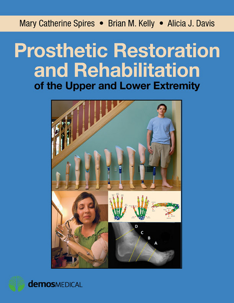 Prosthetic Restoration and Rehabilitation of the Upper and Lower Extremity - CPO MPA  FAAOP Alicia J. Davis,  DO Brian M. Kelly, MD Mary Catherine Spires PT