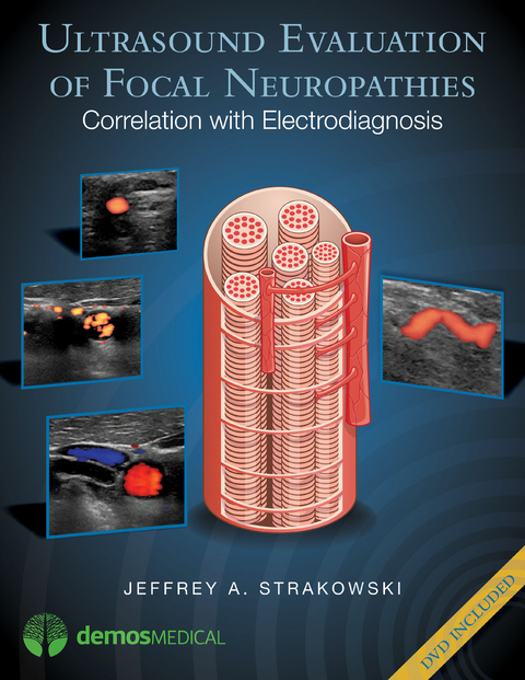 Ultrasound Evaluation of Focal Neuropathies -  MD Jeffrey A. Strakowski