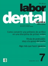 Labor Dental Técnica Vol.22 Octubre 2019 nº7 -  Varios Autores