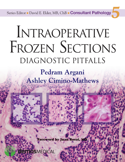 Intraoperative Frozen Sections - Pedram Argani, Ashley Cimino-Mathews