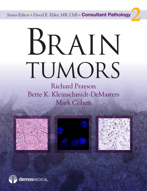 Brain Tumors - Mark Cohen, Bette K. Kleinschmidt-DeMasters, Richard Prayson