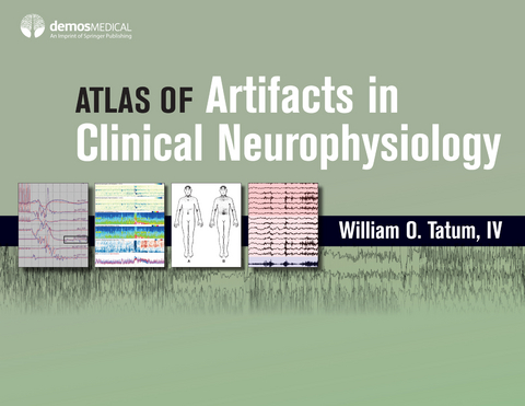 Atlas of Artifacts in Clinical Neurophysiology - DO William O. Tatum IV