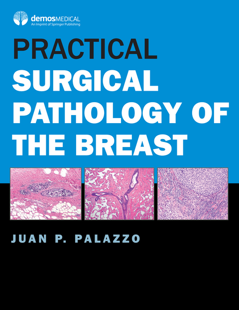 Practical Surgical Pathology of the Breast - Juan P. Palazzo