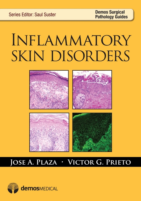 Inflammatory Skin Disorders - Jose Plaza, Victor G. Prieto