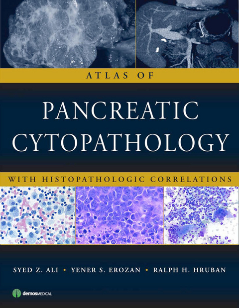 Atlas of Pancreatic Cytopathology - Syed Z. Ali, Yener S. Erozan, Ralph H. Hruban