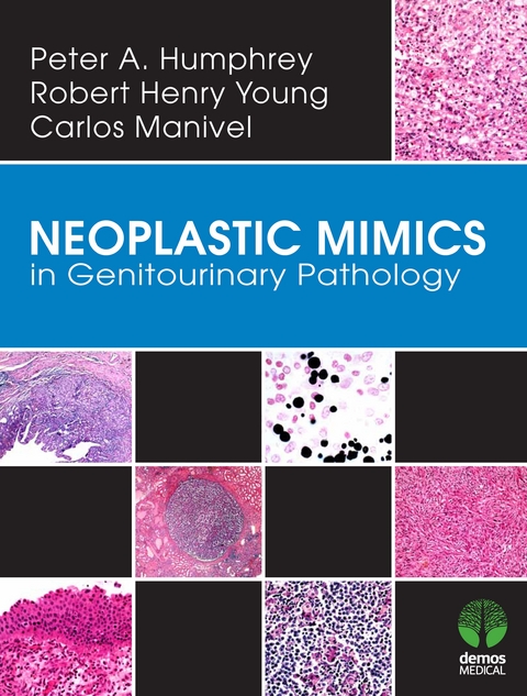 Neoplastic Mimics in Genitourinary Pathology - Peter Humphrey, J. Carlos Manivel, Robert Young