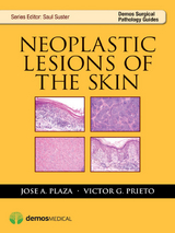 Neoplastic Lesions of the Skin -  MD Jose A. Plaza, PhD Victor G. Prieto MD