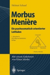 Morbus Meniere - Schaaf, Helmut