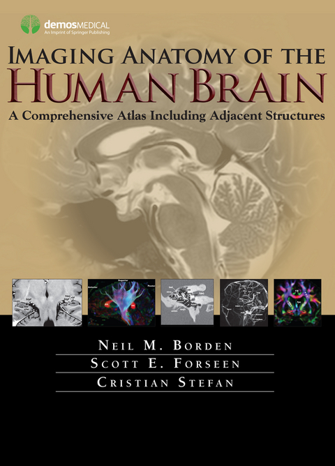 Imaging Anatomy of the Human Brain - Neil M. Borden, Cristian Stefan, Scott E. Forseen