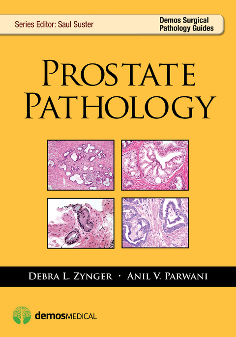 Prostate Pathology - Anil V. Parwani, Debra Zynger