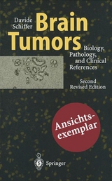 Brain Tumors - Schiffer, Davide