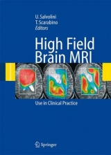 High Field Brain MRI - 