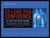 12-Lead EKG Confidence - FACC Anthony J. Chiaramida MD, RN MS APN  NE-BC Jacqueline M. Green