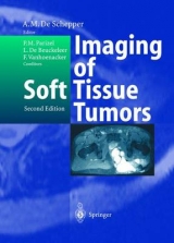 Imaging of Soft Tissue Tumors - 
