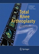 Total Knee Arthroplasty - 