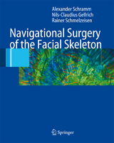 Navigational Surgery of the Facial Skeleton - Alexander Schramm, Nils-Claudius Gellrich, Rainer Schmelzeisen