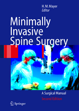 Minimally Invasive Spine Surgery - Mayer, H. Michael