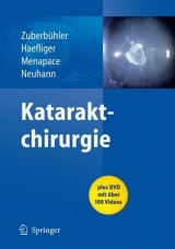 Kataraktchirurgie - Bruno Zuberbühler, E. Haefliger, Rupert Menapace, Thomas Neuhann