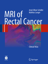 MRI of Rectal Cancer - Arnd-Oliver Schäfer, Mathias Langer