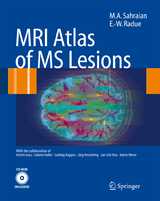 MRI Atlas of MS Lesions - M.A. Sahraian, Ernst-Wilhelm Radü