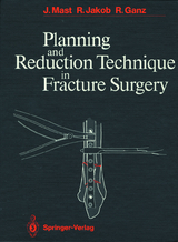 Planning and Reduction Technique in Fracture Surgery - Jeffrey Mast, Roland Jakob, Reinhold Ganz