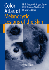 Color Atlas of Melanocytic Lesions of the Skin - 