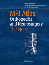 MRI Atlas - Martin Weyreuther, Christoph E. Heyde, Michael Westphal, Jan Zierski, Ulrich Weber