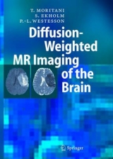 Diffusion-Weighted MR Imaging of the Brain - T. Moritani, S. Ekholm, P. L. Westesson