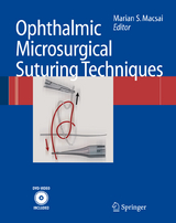 Ophthalmic Microsurgical Suturing Techniques - 