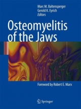 Osteomyelitis of the Jaws - 