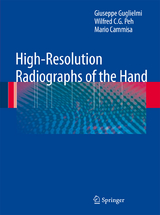 High-Resolution Radiographs of the Hand - Giuseppe Guglielmi, Wilfred C. G. Peh, Mario Cammisa
