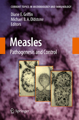 Measles - 