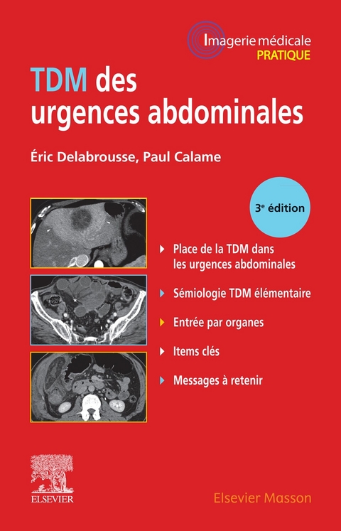 TDM des urgences abdominales -  Paul Calame,  Eric Delabrousse