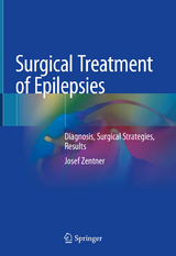 Surgical Treatment of Epilepsies -  Josef Zentner